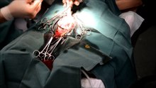 Cesarean Frustyle Bon Marta 13-01-2015