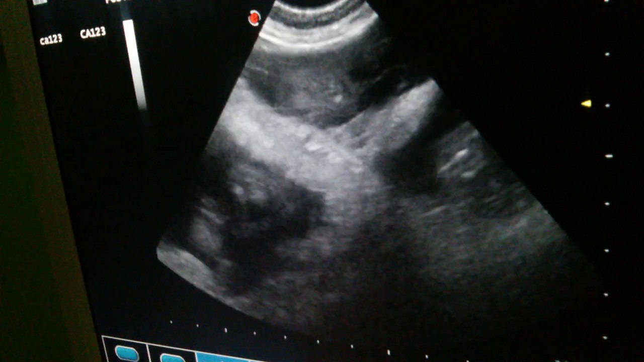 Be Aware H-Wurf/Litter - 39.Tag/Day