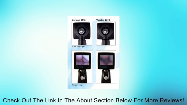 MD Scope MS101 Video Otoscope/Earscope, ENT otoscope, Veterinary Otoscope + matching cradle + 2 plastic camera guards + 1 video-out cap + 2 x AA alkaline batteries + 24 disposable specula + 1 instruction manual + 1 guarantee card (validity of 1 year) +