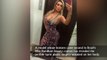 Plastic surgery Horribly gone wrong for Miss BumBum Contestant, Andressa Urach