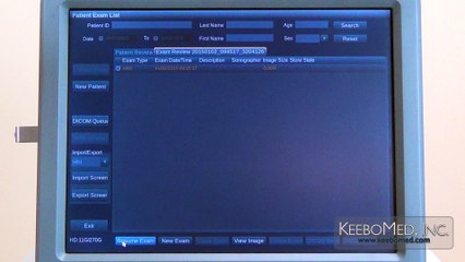 SonoScape S2 | Deleting Patient Information