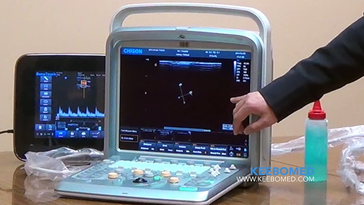 Chison Q9 Demo KeeboMed