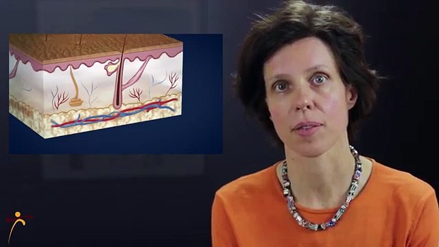 Acne Treatment in Philadelphia - By Dr. Ringpfeil - Board Certified Dermatologist