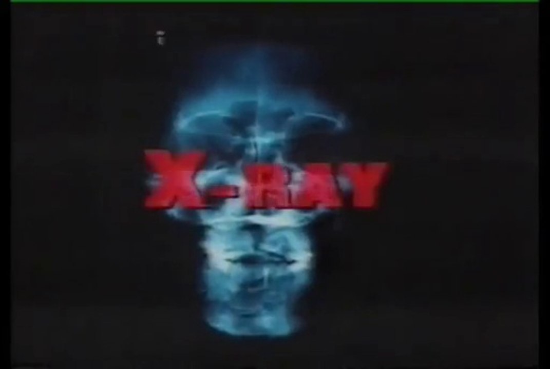 X-Ray (Hospital Massacre - 1982)