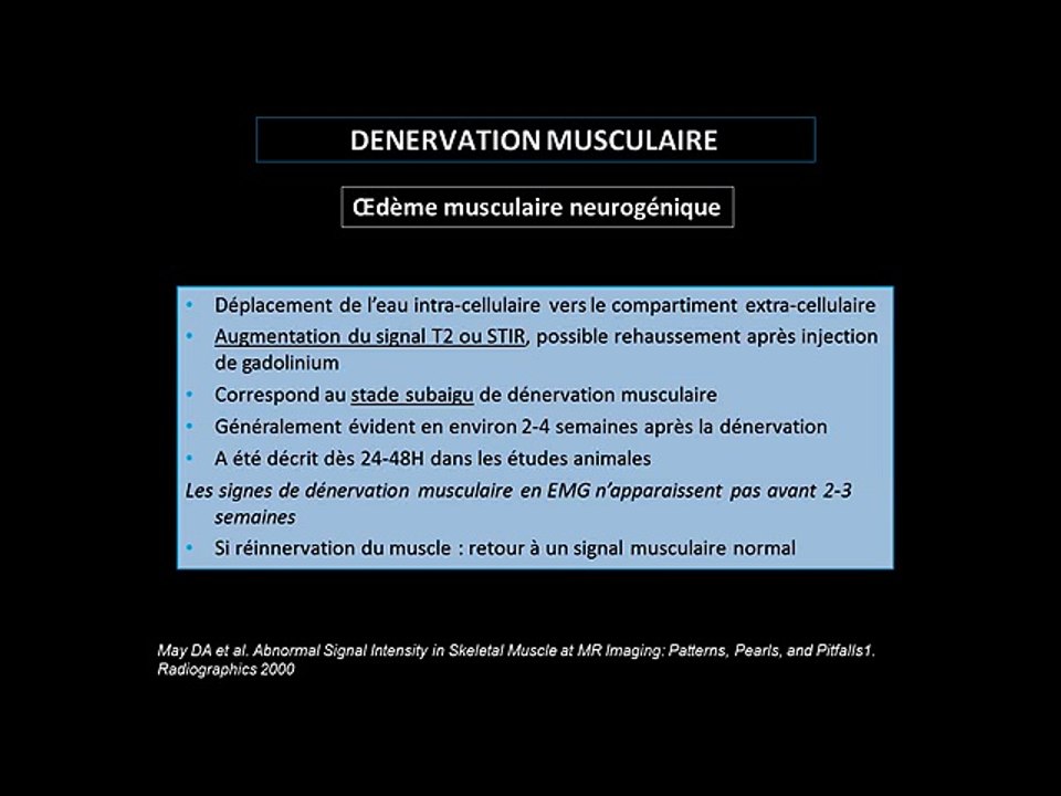 Atteinte inflammatoire du plexus