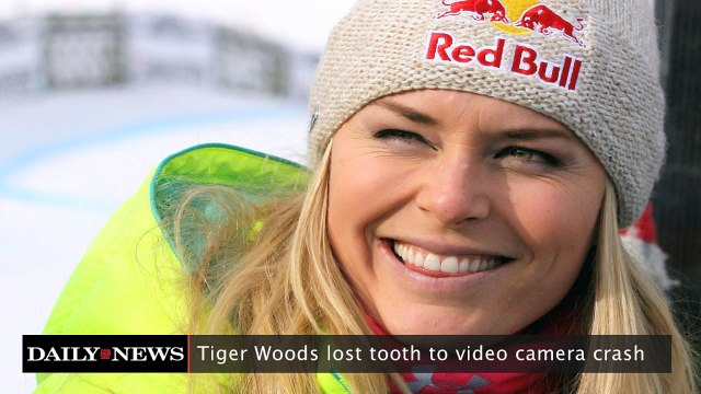 Tiger Woods Lost Tooth to Video Camera Crash