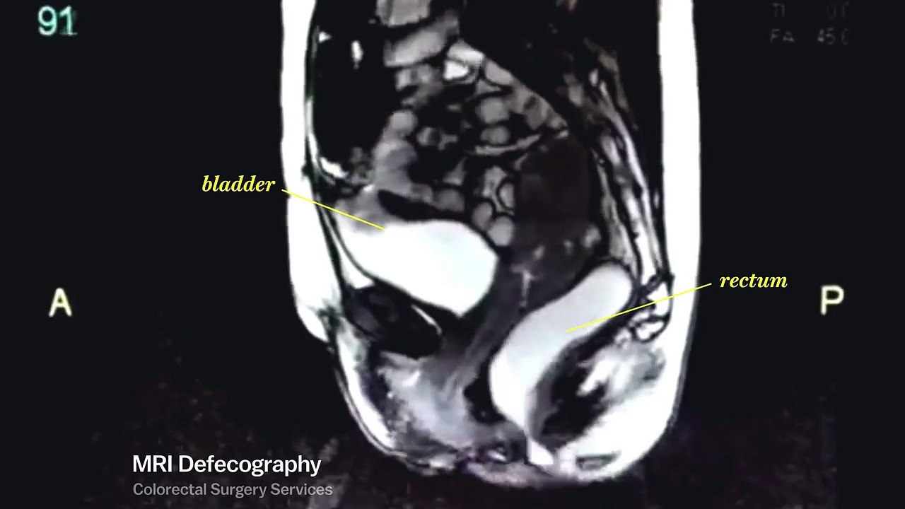 Life looks really different through an MRI machine