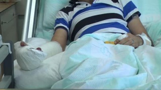 Kopan Parmakları 10 Saatte Dikildi