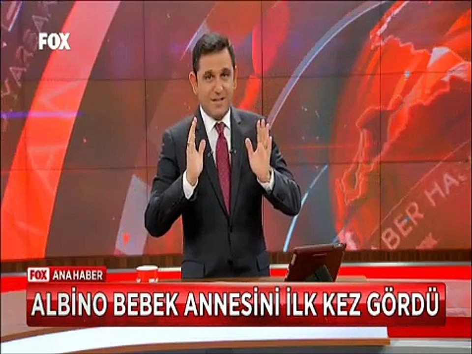 Annesini ilk kez gören Albino hastası bebeğin tepkisi