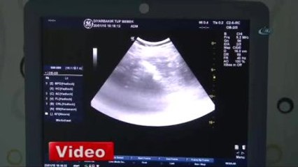 Makyaj Malzemeleri Kısır Yapıyor!