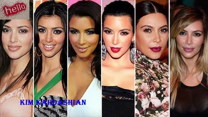 Les stars avant et après la chirugie esthetique / Celebrities before and after aesthetic Surgery