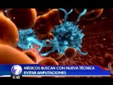 Implementan en Hospital México novedoso tratamiento contra el cáncer