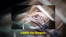 What You Need to Know About LASIK Eye Surgery