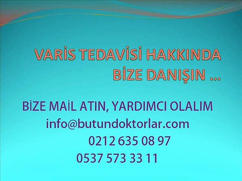 VARİS danışma 0535 3573503, varis ameliyatı sonrası,varis ameliyatı izle,varis ameliyatı video,varis tedavisi,varis belirtileri,varis ameliyatı lazer,