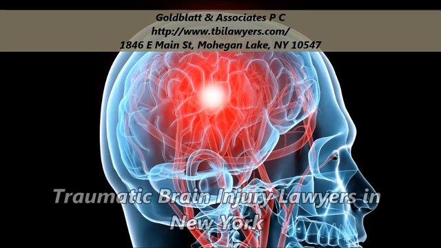 Goldblatt & Associates P C : Personal Injury Attorney New York