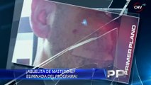 El grave y oculto accidente de participante de Master Chef durante las grabaciones - PRIMER PLANO