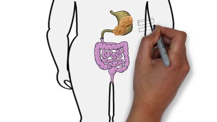 Les allergies alimentaires en chiffres