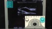 Best Color Doppler Ultrasound Scanner SonoScape S8 / System Controls