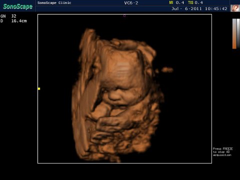 4D Sonoscape S8 Color Doppler Ultrasound / Real Baby