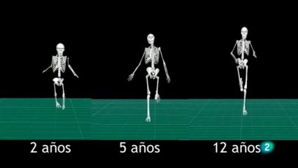 Cerebro y equilibrio: Ontegenia de la bipedestacion