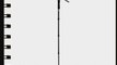 Benro Video Monopod with Twist Lock Legs S2 Head and 3 Leg Base (Black) with an Extra Video