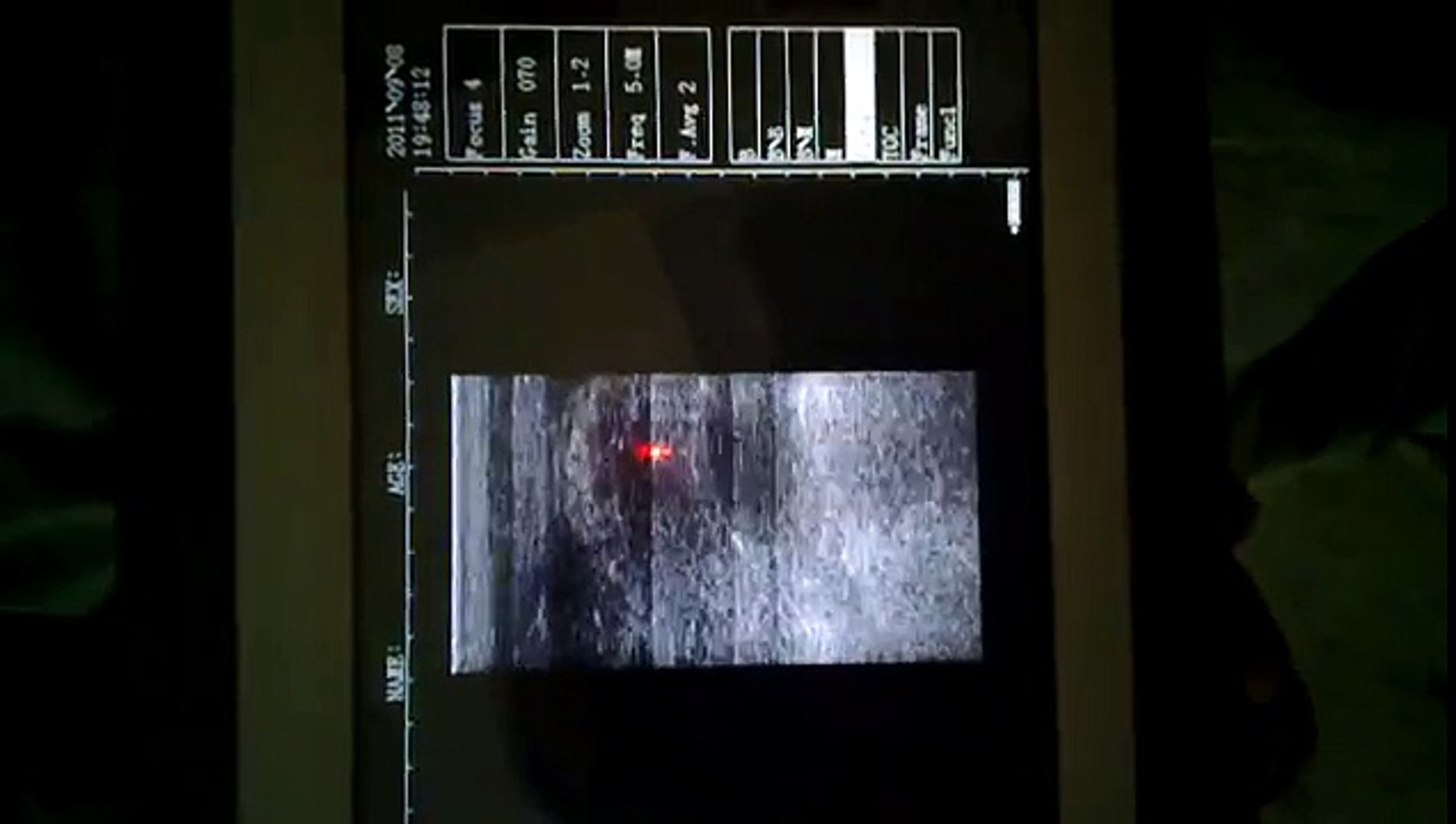 ⁣KUS3200 Palm Sized Veterinary Ultrasound
