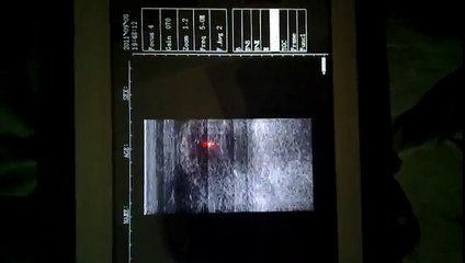 KUS3200 Palm Sized Veterinary Ultrasound