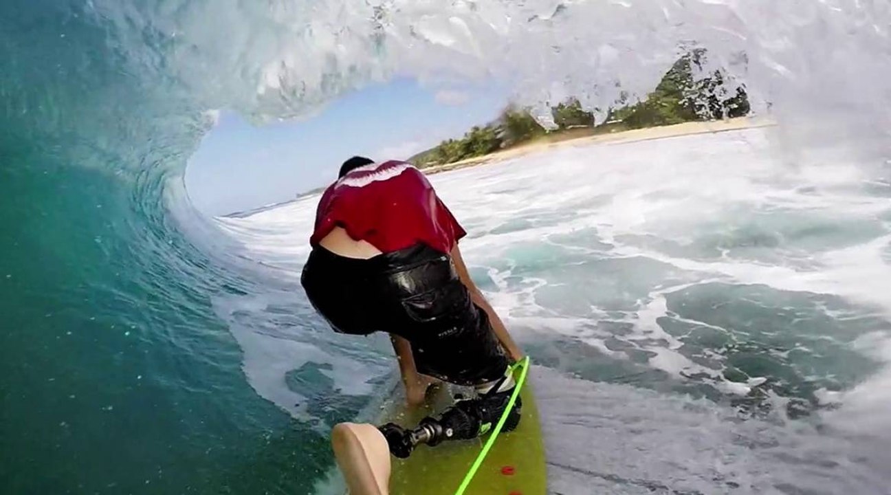Le surf backside avec une prothèse