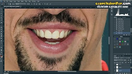 Ribery O Trafik Kazasını Yaşamasaydı Nasıl Görünecekti?