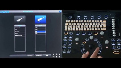 Chison ECO3 Portable Ultrasound / Setup Tutorial