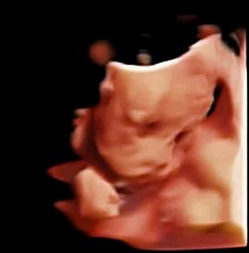 Volumetric Probe Scanning / Chison Q5%2C Q9 4D Virtual HD / Low Cost 4D Ultrasound