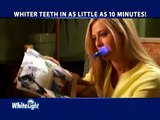 White Light Lazerli Diş Beyazlatma Seti