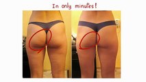 Treatment for cellulitis at home _How to Get Rid of Cellulite on Thighs Naturally1
