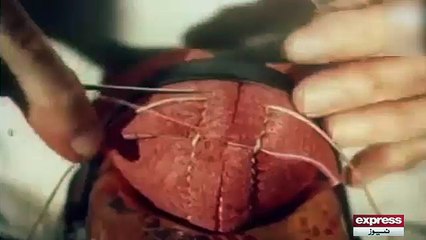 Manufacturing of ball