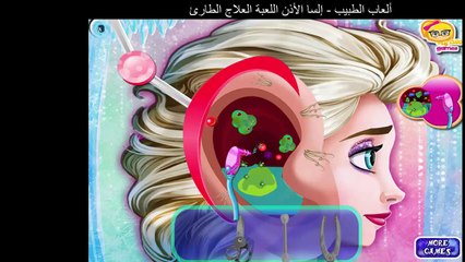 ألعاب الطبيب - إلسا الأذن اللعبة العلاج الطارئ