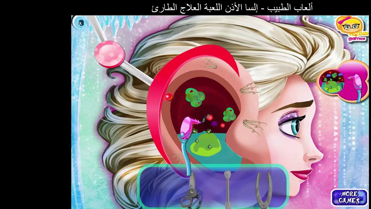 ألعاب الطبيب - إلسا الأذن اللعبة العلاج الطارئ