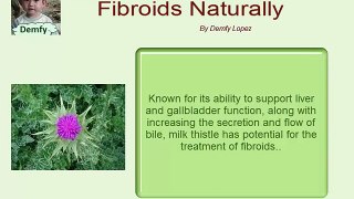 How To Dissolve Fibroids Naturally
