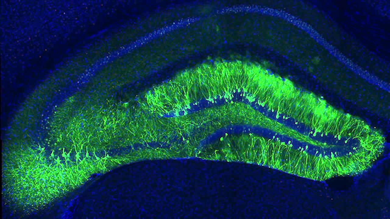 Une carte mémoire implantée dans le cerveau