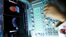 Operational Video | Chison Q9 or Q9Vet | Color Doppler Ultrasound Instructions How to Use