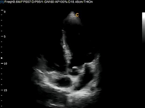 Q9 Chison 12 Screen user friendly Ultrasound Cardiac Aplication