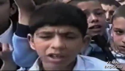 Kızlar Bize Kel Diyor Alay Ediyorlar (Nostaljik Haber)