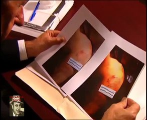 Crimenes Imperfectos-Imagen más Ní­tida 25 04 2013