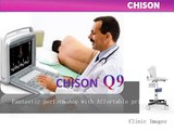 CHISON Q9 Color Doppler Ultrasound | High Quality Clinic Images with Continuous Wave Display