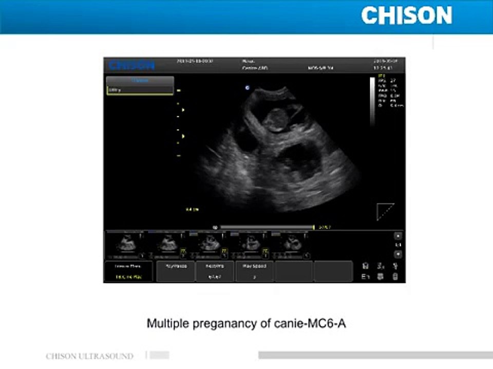 Chison ECO3VET Portable Ultrasound-newest model with THI,compund imaging,trapesoidal,i image