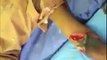 بھاولپور کے ویکٹوریا ہسپتال کے ایک ڈاکٹر کا انوکھا کارنامہ، پاکستانی جب دل سے