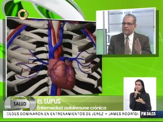 El lupus se da con frecuencia en las mujeres