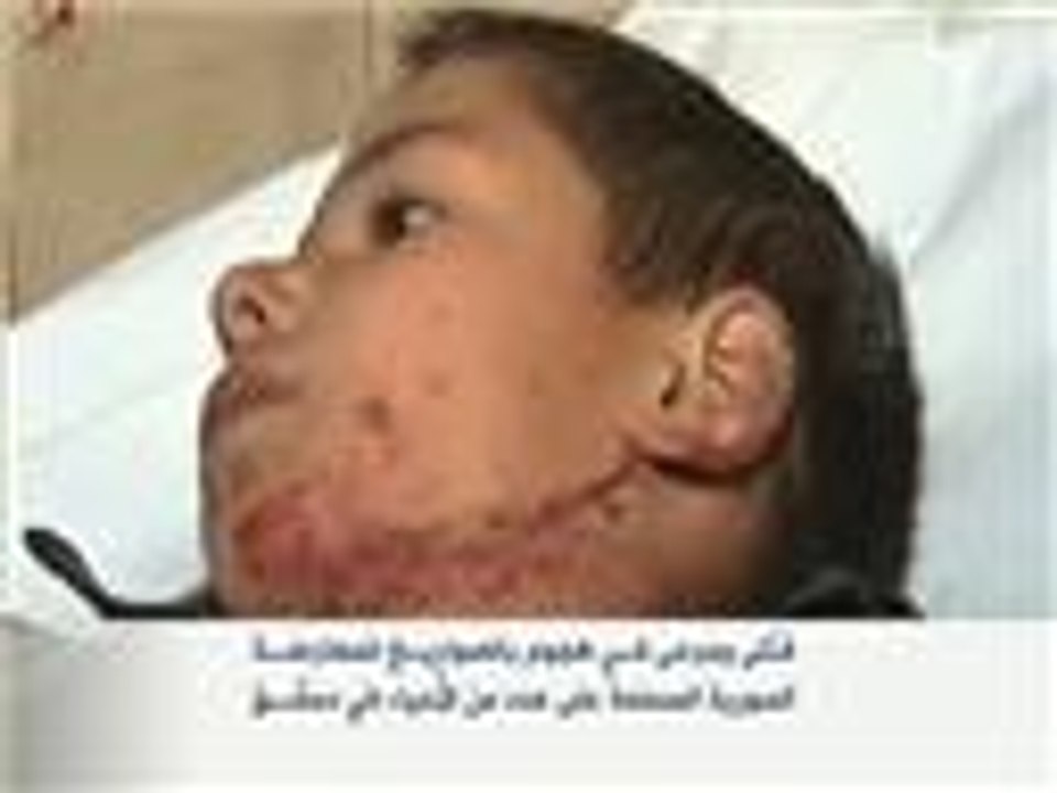 عشرات القتلى والجرحى بقصف طيران النظام للغوطة الشرقية