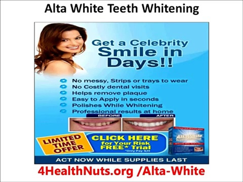 Sinsational Smile teeth whitening