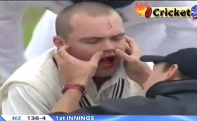 Deadly Bouncer from JAMES ANDERSON, "Daniel Flynn" lose a Tooth (Missing Teeth)