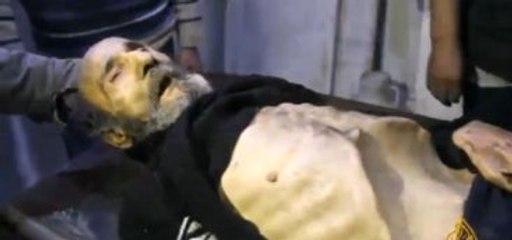 Yaşlı Suriyeli'nin Son İsteği Yemek Yemekti Ama Olmadı